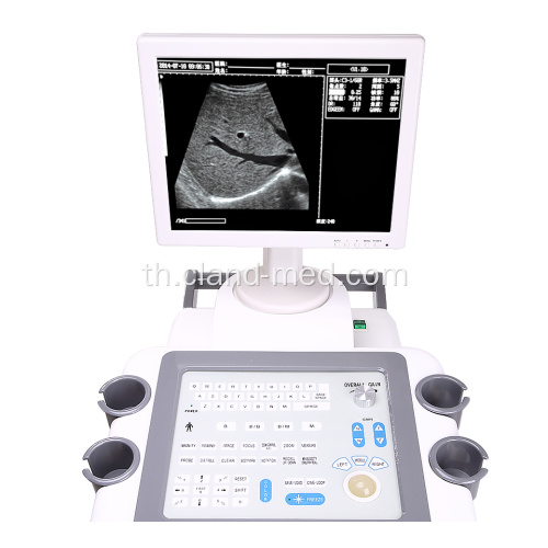 B / W Trolley Ultrasound Scanner ราคาเครื่องอัลตร้าซาวด์ที่ดี